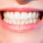 Śliczne nienaganne zęby także doskonały cudny uśmiech to powód do zadowolenia.